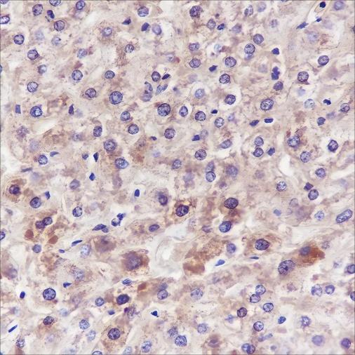 Recombinant ANGPTL3 Monoclonal Antibody - 2
