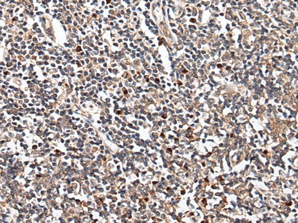 Immunohistochemistry of paraffin-embedded Human tonsil tissue  using HOXB9 Polyclonal Antibody at dilution of 1:45(?200)