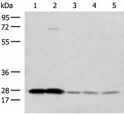 Western blot analysis of Human cerebella tissue Human cerebrum tissue Human skin tissue NIH/3T3 cell SKOV3 cell lysates  using OVOL2 Polyclonal Antibody at dilution of 1:350