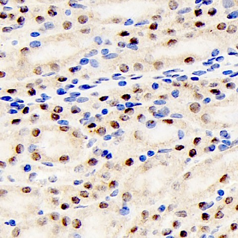 Immunohistochemistry analysis of paraffin-embedded mouse kidney  using PPARA Polyclonal Antibody at dilution of 1:200.