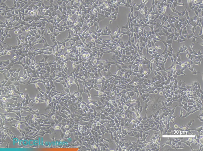 TC-1 [Mouse lung]TC-1 [Mouse lung] - 1