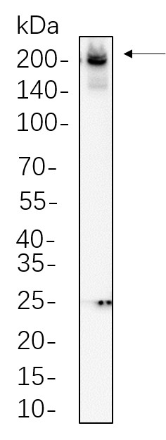 Recombinant Collagen II Monoclonal Antibody-searchlist-1