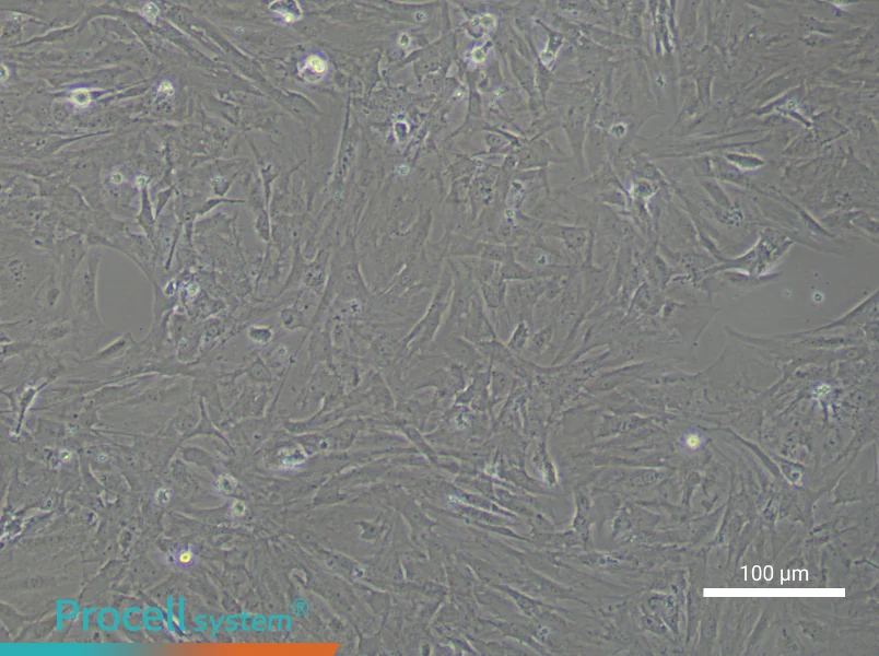 Mouse Brain Microvascular Pericytes - 1