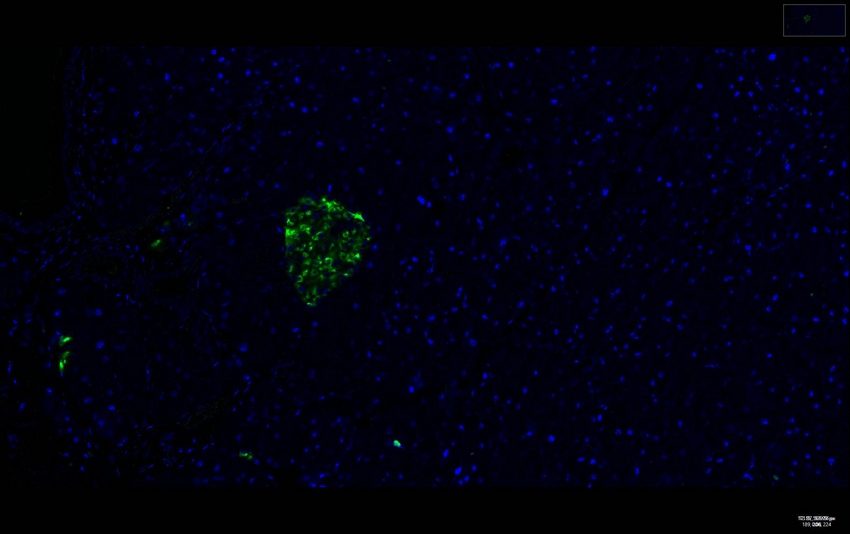 Recombinant Chromogranin A/CHGA/CGA Monoclonal Antibody - small - 7