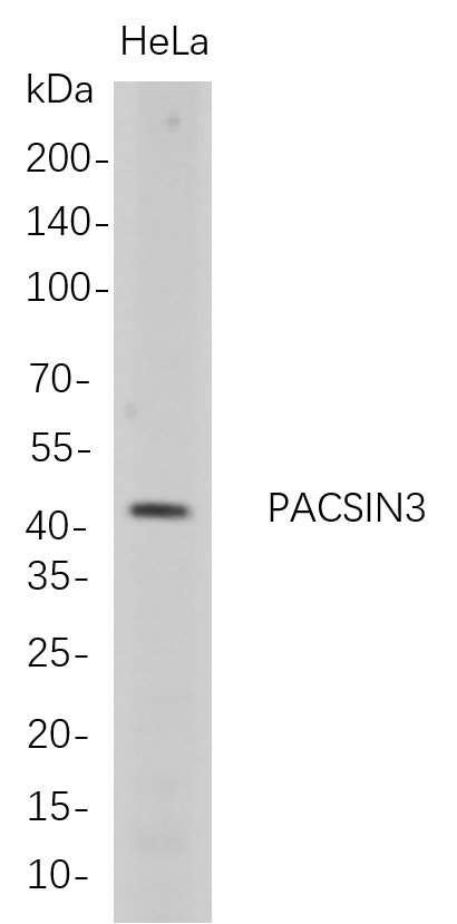 Recombinant PACSIN3 Monoclonal Antibody-searchlist-1