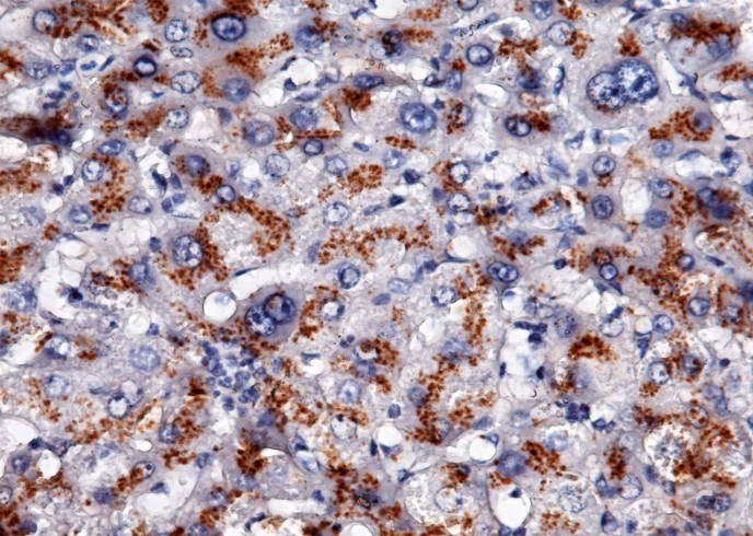 Recombinant Apolipoprotein H/APOH Monoclonal Antibody-searchlist-1