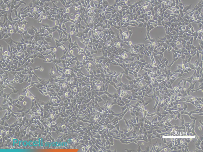 TC-1 [Mouse lung]TC-1 [Mouse lung] - 3