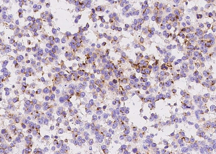 Recombinant Synaptophysin/SYP Monoclonal Antibody - small - 5