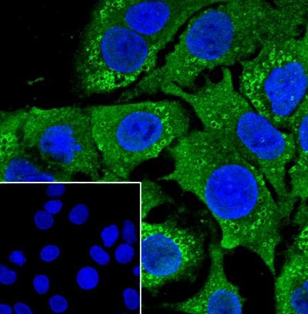 Recombinant Perilipin-2 Monoclonal Antibody-searchlist-2