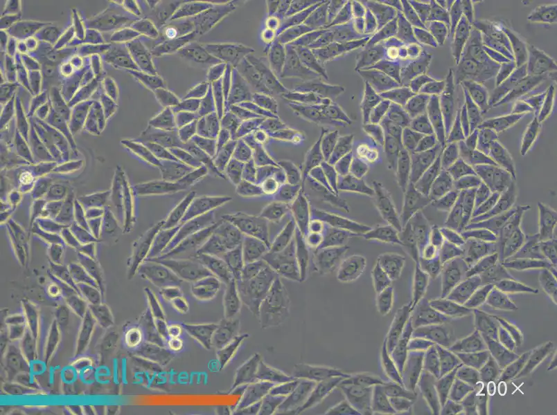 SiHa Cell Complete Medium - small - 5