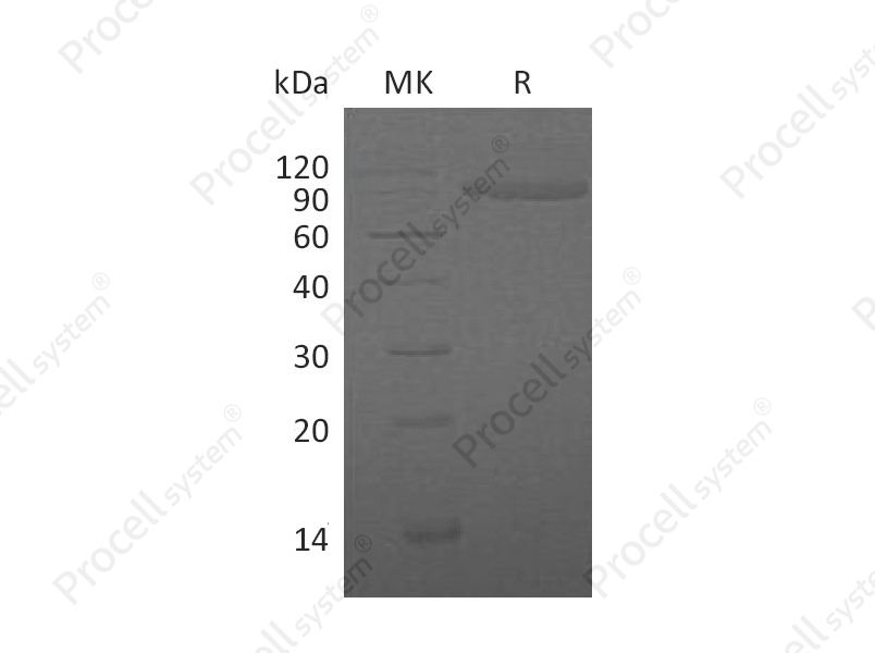 IL-1R-2/CD121b (C-Fc), Human, Recombinant