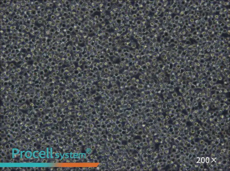 NOMO-1 Cell Complete Medium - 4