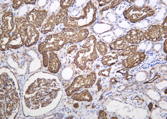 Recombinant AQP1 Monoclonal Antibody-searchlist-1
