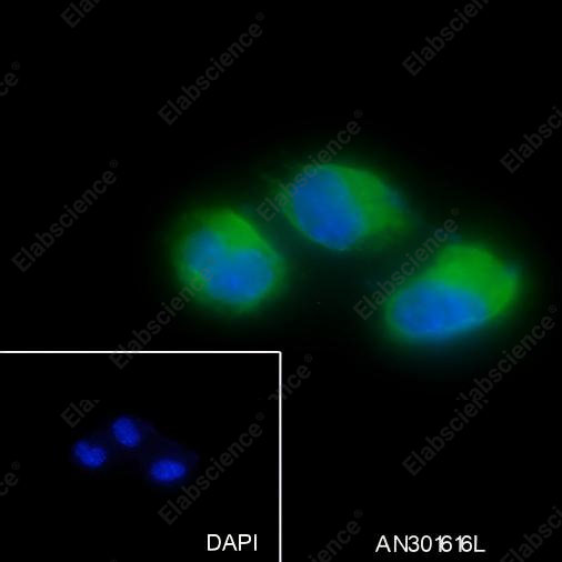 Recombinant ARPC5/p16 ARC Monoclonal Antibody - 4