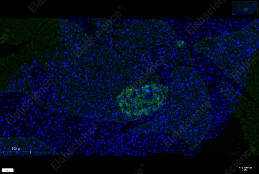 Recombinant Chromogranin A/CHGA/CGA Monoclonal Antibody - 4