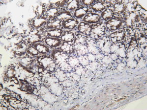 Recombinant Histone H1.2 Monoclonal Antibody - 2