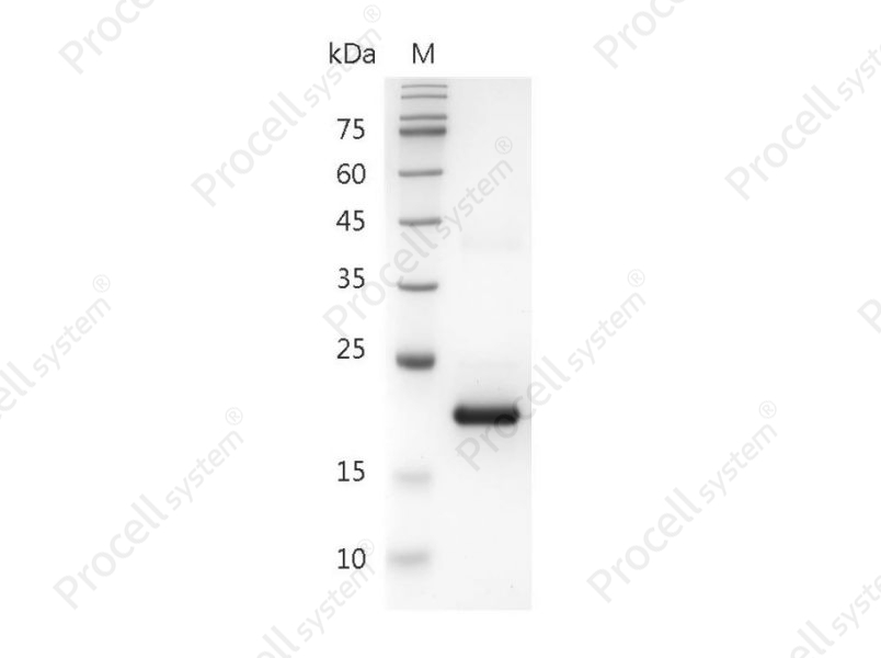 IFN&alpha; 1a/IFNA2, Human, Recombinant