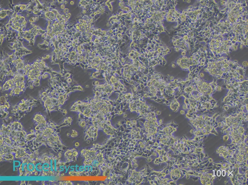 KM12 Cell Complete MediumKM12 Cell Complete Medium - 2