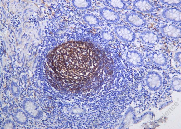 Recombinant NGFR p75 Monoclonal Antibody - 2