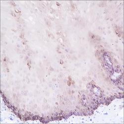 Recombinant Keratin 15 Monoclonal Antibody - 3