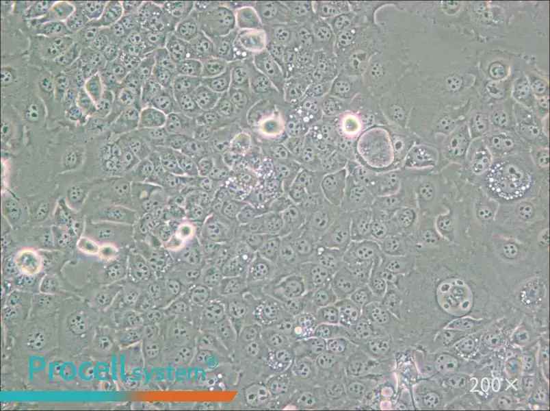 KYSE-30 Cell Complete Medium - small - 6