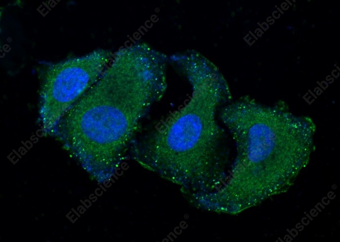 RELT/TNFRSF19L Monoclonal Antibody - 1