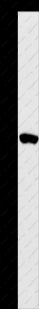 ANGPT2 Polyclonal Antibody - 1