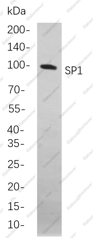 Recombinant SP1 Monoclonal Antibody - 1