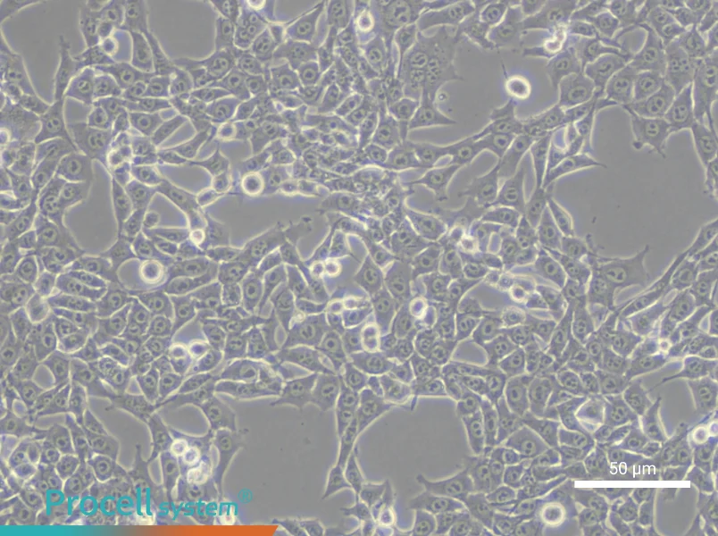TC-1 [Mouse lung]TC-1 [Mouse lung] - 6