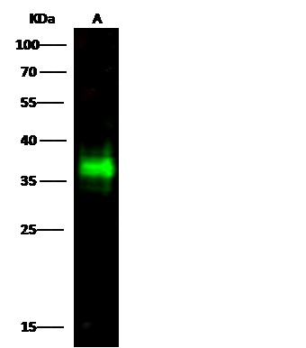 Recombinant CD7 Monoclonal Antibody - small - 2