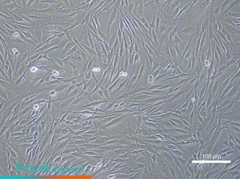 Human Coronary Artery Smooth Muscle Cell Complete MediumHuman Coronary Artery Smooth Muscle Cell Complete Medium - 2