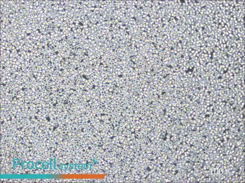 NB4 Cell Complete Medium - 3