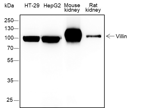 Recombinant Villin Monoclonal Antibody-searchlist-1