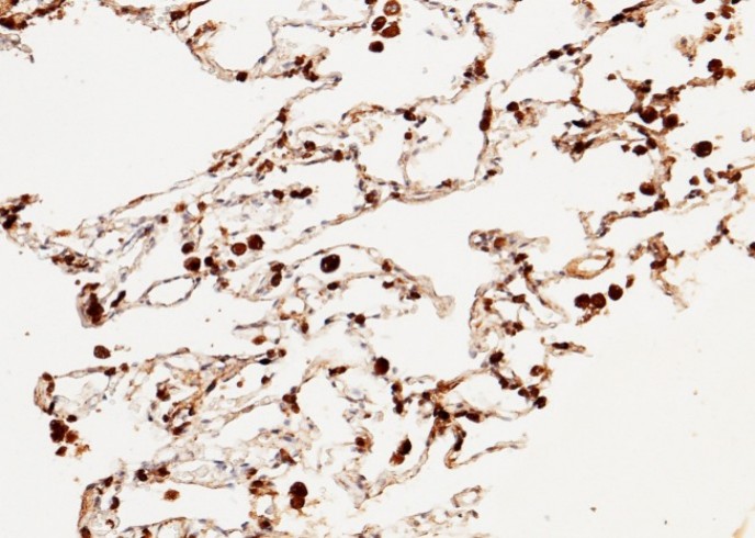 CD63 Monoclonal Antibody - small - 2