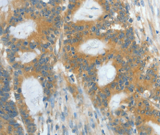 ASPA Polyclonal Antibody - 3