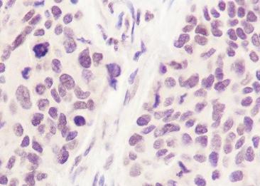 Recombinant Phospho-SIRT1(Ser47) Monoclonal Antibody-searchlist-2