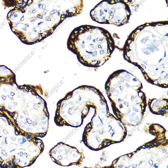 FGFR2 Polyclonal Antibody - 5