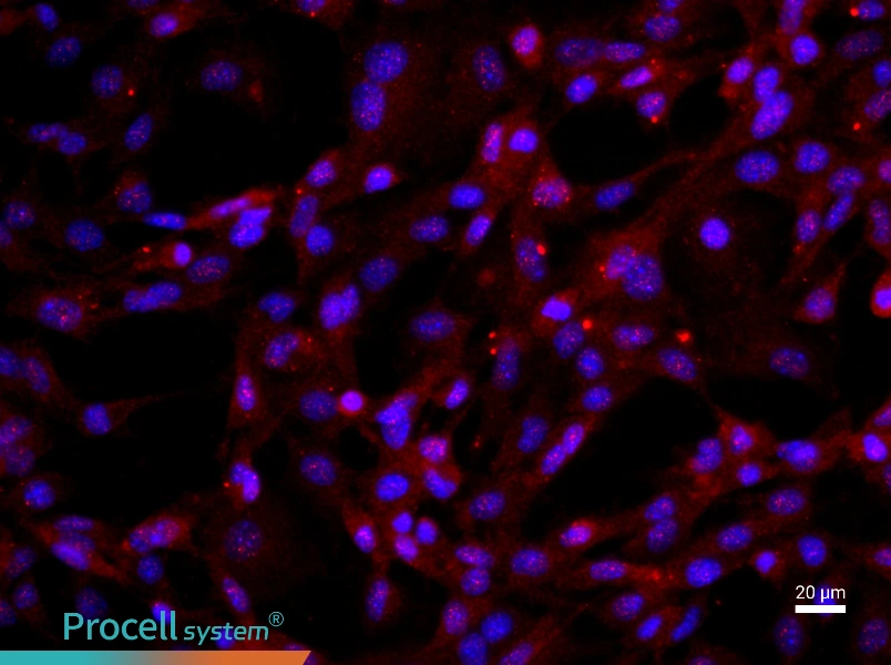 Human Articular Chondrocyte Complete Medium - 2