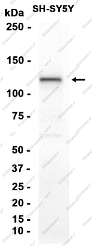 Recombinant BUBR1 Monoclonal Antibody - 2