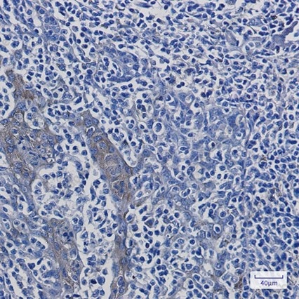 Recombinant ATP6V1A Monoclonal Antibody - 3