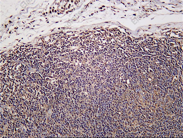 Recombinant PRKAR2A Monoclonal Antibody - 1