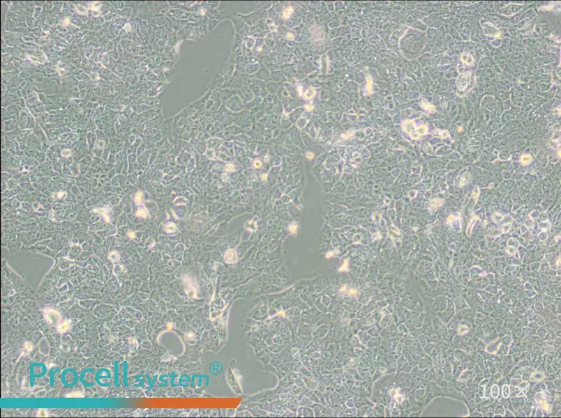 NCI-H2228 [H2228; H-2228] Cell Complete Medium - 2
