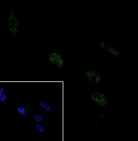 Recombinant IGJ Monoclonal Antibody - small - 3
