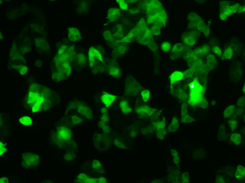 Hep G2-GFP Cell Complete Medium - 5