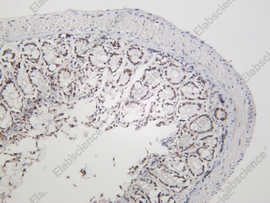 Recombinant RCC1 Monoclonal Antibody - 2