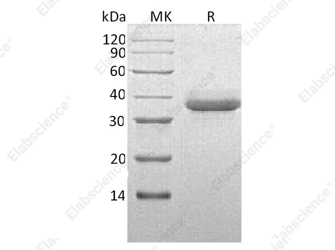 Recombinant Human Chymotrypsin C Protein (His Tag) - 1