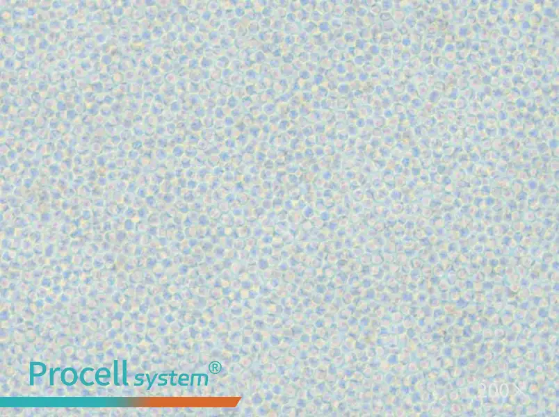 OCI-AML-2 Cell Complete Medium - 4