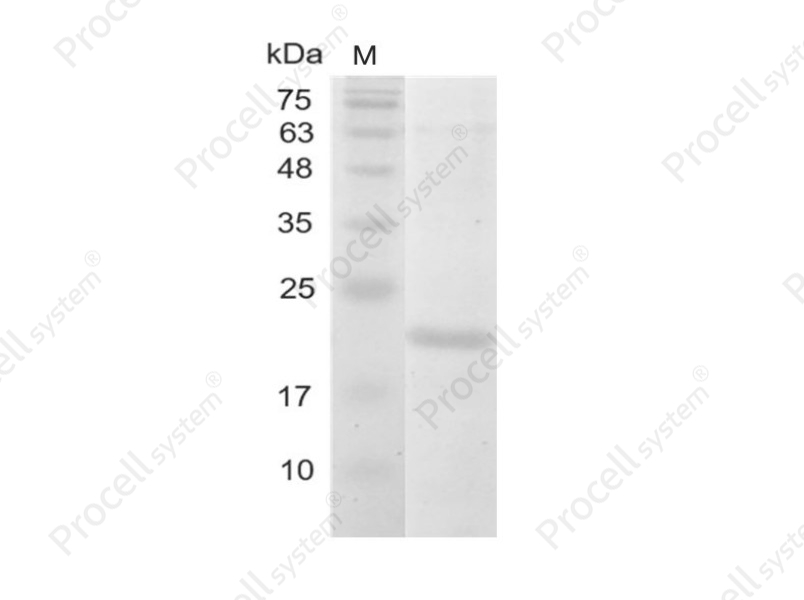 IL-38/IL-1F10/IL-1HY2, Human, Recombinant