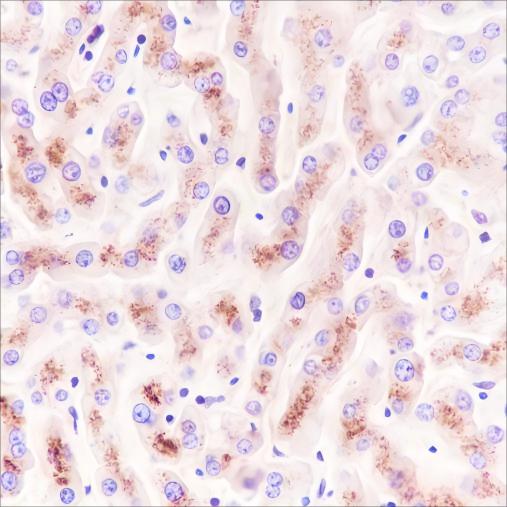 Recombinant CHMP2B Monoclonal Antibody - small - 2
