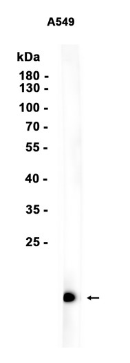 Recombinant Uteroglobin/SCGB1A1 Monoclonal Antibody - 1